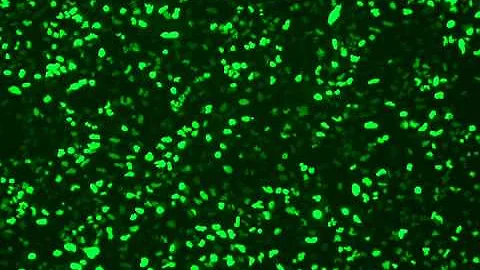 A549 H2B GFP Time-lapse