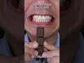 Most Satisfying Candy &amp; Chocolate ASMR 🍫🍬 #DoctorTristanPeh #ASMR