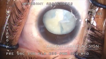 Argentinian Flag Sign