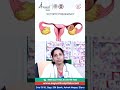 Early Detection Saves Lives: Ectopic Pregnancy Awarenessa