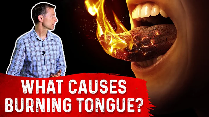The Causes & Treatment of Burning Tongue (Mouth) – Dr. Berg - DayDayNews