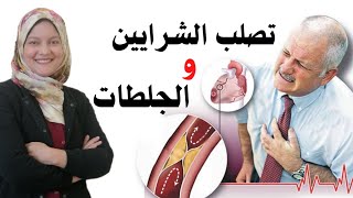 تصلب الشرايين والجلطات ?atherosclerosis