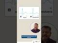 ECG Changes that Happen Due to Electrolyte Disturbances | Dr Archith Boloor