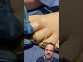 DOCTOR REACTS ARE THESE TOENAILS DEAD 亞 Shorts DOCTOR REACTS ARE THESE TOENAILS DEAD 亞 Shorts