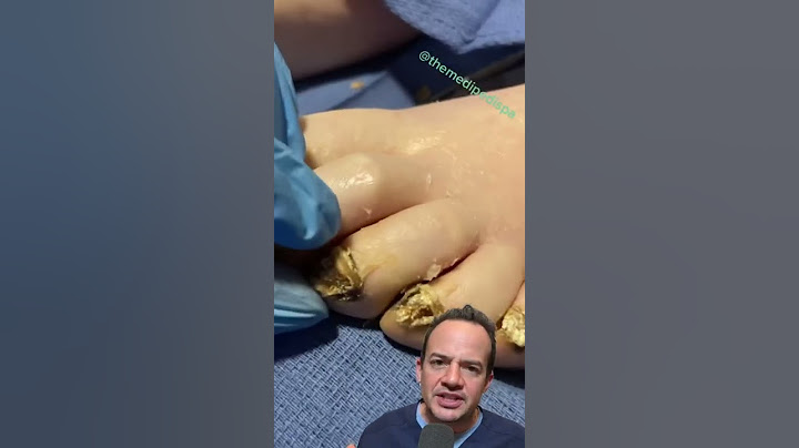 DOCTOR REACTS: ARE THESE TOENAILS DEAD? 😱 #shorts