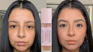 FULL COVERAGE FRIDAY: *DRUGSTORE* MAKEUP REVOLUTION CONCEAL &amp; HYDRATE FOUNDATION | ZOEY