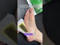 Ese parche que hace que tus pies no estén helados en invierno.