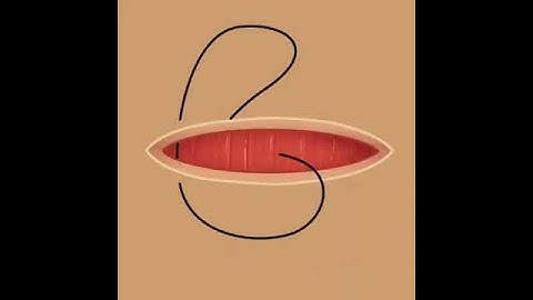 Simple Interrupted Suture Animation | Med Plus |
