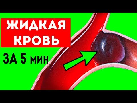 Как за 5 мин РАЗЖИЖАТЬ густую кровь БЕЗ лекарств!