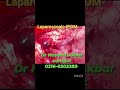 Laparoscopic paraumbilical hernia repair — a step forward in advanced laparoscopic surgery.