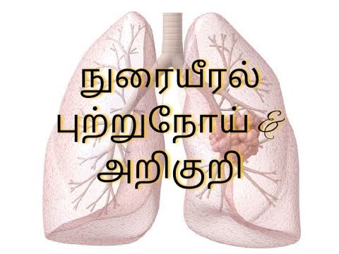 நுரையீரல் புற்றுநோய் காரணங்கள் மற்றும் அறிகுறி