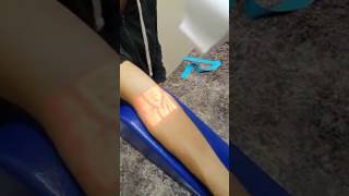 New Technology for easy vein detection.. 👍 👍 screenshot 3