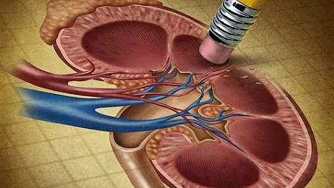 Cosa comporta lo zucchero nelle urine?