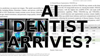 AI Dentist: How YOLO26 is Changing Dental X-Ray Analysis Forever