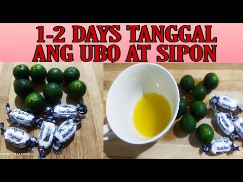 Mabisang Gamot sa Ubo&rsquo;t Sipon || 1-2 days tanggal ang iyong sakit