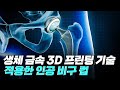 생체 금속 3D 프린팅 기술을 적용한 인공 비구 컵