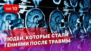 ТОП 10 людей, которые стали гениями из за травмы мозга