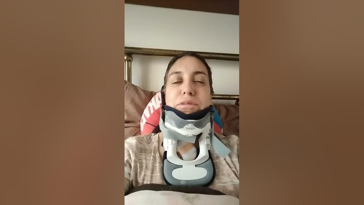 Recuperación Operación Cervicales C5C6 y C6C7 YouTube