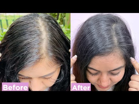 Spa Treatment at Your Home | L'Oreal Paris Hyaluron Pure Range | JSuper Kaur