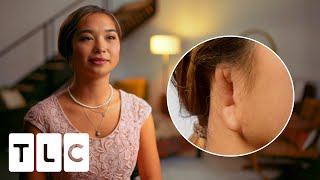 Microtia Leaves Her Without Her Right Ear And Lacking Confidence L Body Parts