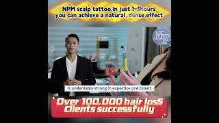 Singapore&#39;s Leading Scalp Tattoo Service – NPM SMP with Award-Winning Expertise!  #scalptattoo #smp