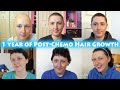 Hair Growth After Chemo! ONE YEAR | My Cancer Story