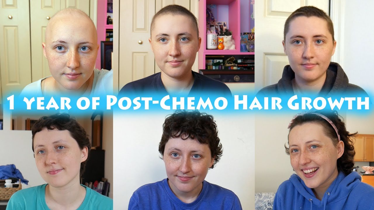 Collage My hair growth duringafter chemo  Hair growth after chemo Hair  growth for men Hair growth