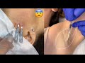 Most Extreme Beauty Treatments 2021 Best Smart and Helpful Beauty Hacks | Virtual Beauty