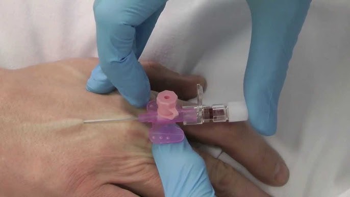 Performing a venipuncture using a butterfly needle 