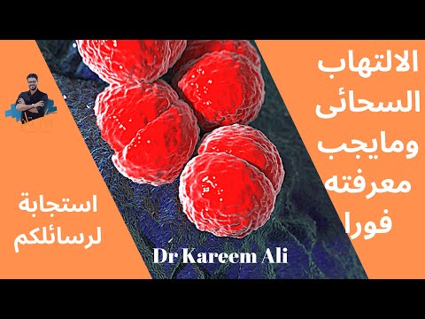 ١١٥- الالتهاب السحائي/ مايجب معرفته فورا لحماية اطفالك/ حلقة خاصه_ الاعراض والوقاية