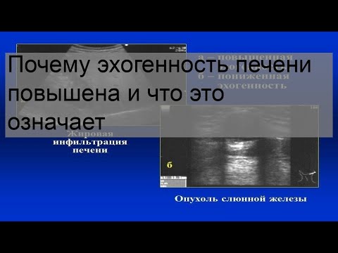 Почему эхогенность печени повышена и что это означает