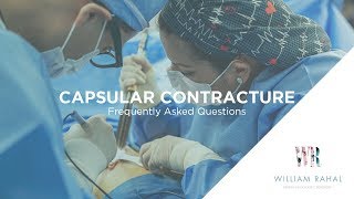 Capsular Contracture Frequently Asked Questions