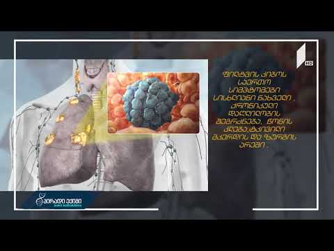 #პირადიექიმი ქალებში ფილტვის კიბოს შესაძლო მიზეზები, სიმპტომები და გამოვლენა