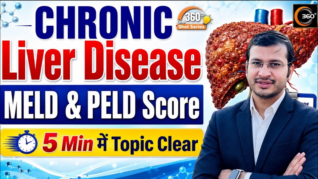 Chronic Liver Disease Scoring Tools Explained | 360 Degree One Shot | Siddharth Sandu Sir