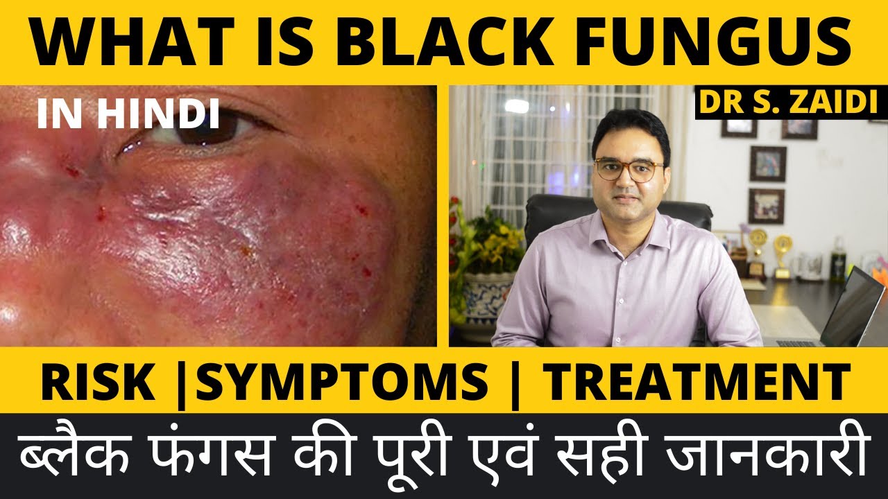 Black Fungus Kya Hai Black Fungus Symptoms Risk For Covid Patients