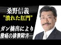 【クワマン】桑野信義 ガン手術後の”排泄障害”によりただれた肛門が潰れて生き地獄…大腸の位置がお腹ではない別の場所に！？
