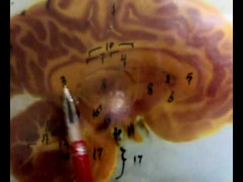 NEUROANATOMY الجزء الثانى "شرح"BRAIN & BRAIN STEM" - YouTube