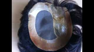 増毛コーティング修理を行う新潟の医療用専門のカツラ屋さんとは