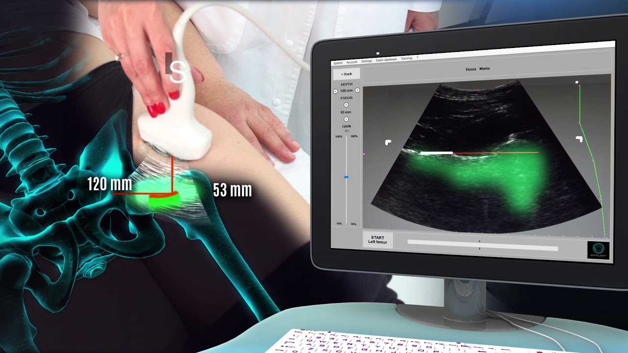 EchoS Scan Femur - VOICE