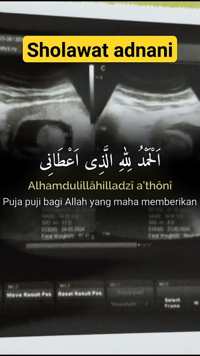 sholawat Adnani #sholawat #sholawatnabi #fypシ