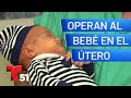 Operan al bebé en el útero: madre cubana recibe milagrosa operación en el hospital Jackson