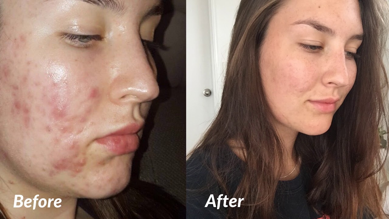 How I Improved My Skin Care Products In India In One Day