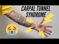 Carpal Tunnel Syndrome Pain Rehab 2020