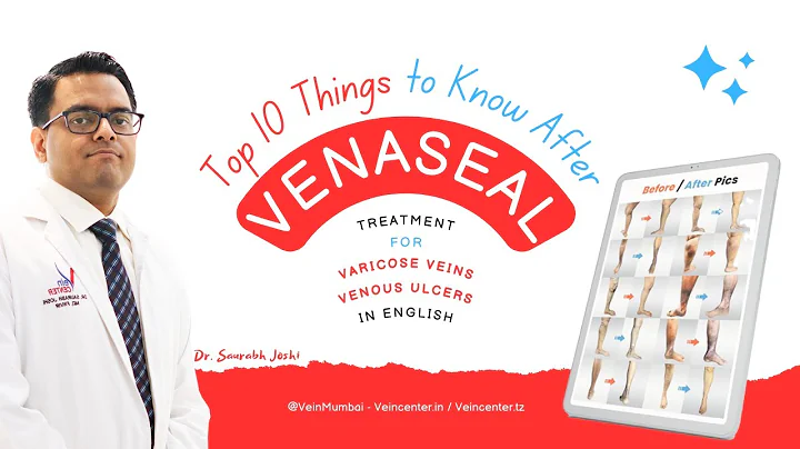 10 Things You Should Know After #venaseal #varicoseveins  Procedure in English by Dr. Saurabh Joshi