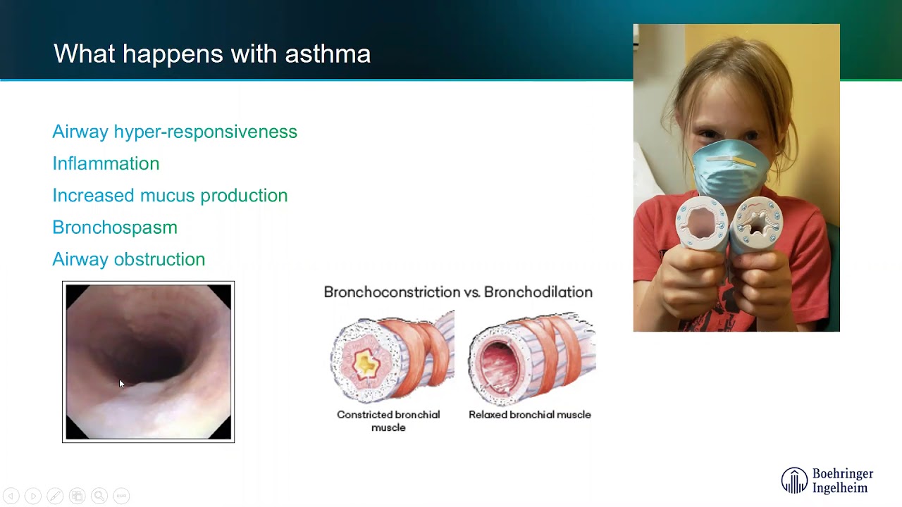 Innovations in Equine Asthma Part 2