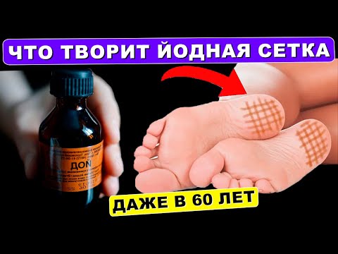 Что Произошло После 5 раз! Для ЧЕГО На НОЧЬ Мажут ПЯТКИ Йодом? Вы очень сильно удивитесь!