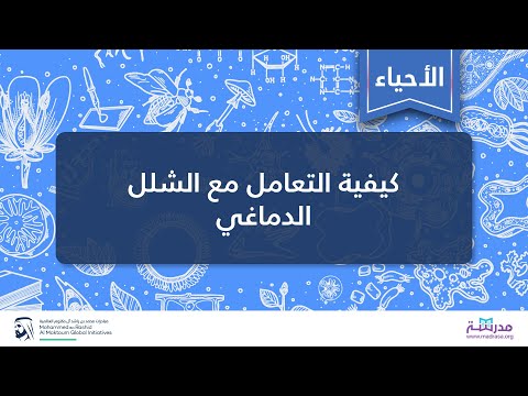 كیفیة التعامل مع الشلل الدماغي | الأحیاء | الصحة النفسیة