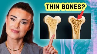 Doctor Explains Osteoporosis How To Protect Your Bones And Prevent Fractures
