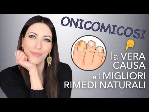 Video: È lo scopo delle unghie dei piedi?