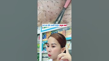 Lông Mọc Ngược Có Nổi Mụn Mủ Không #shorts #diemthuyduocsigiadinh